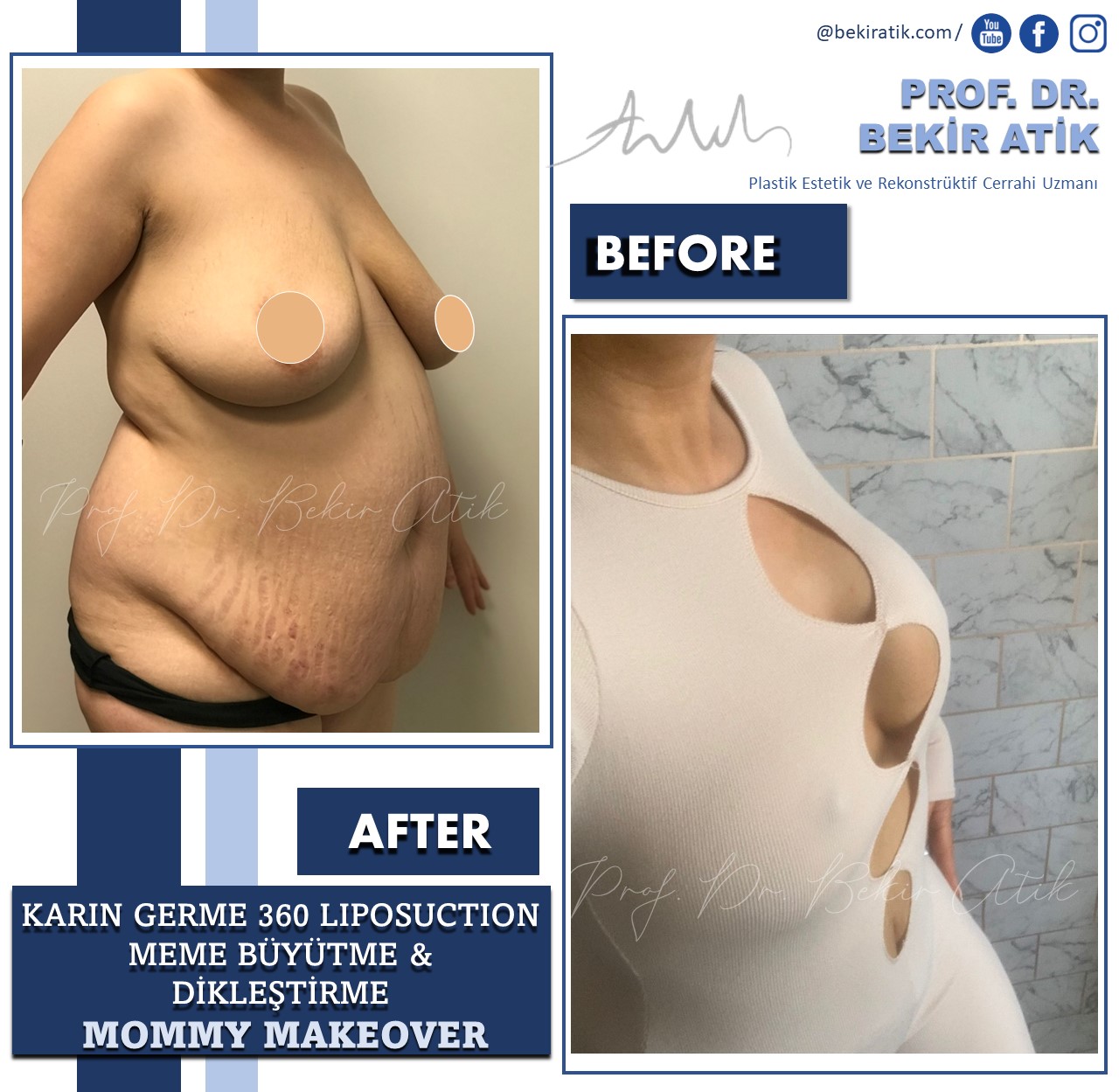 Cosmetic surgery Turkey